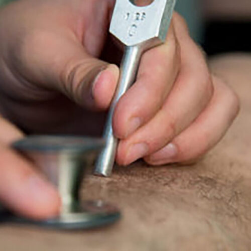 therapist using a tuning fork on a patient's leg