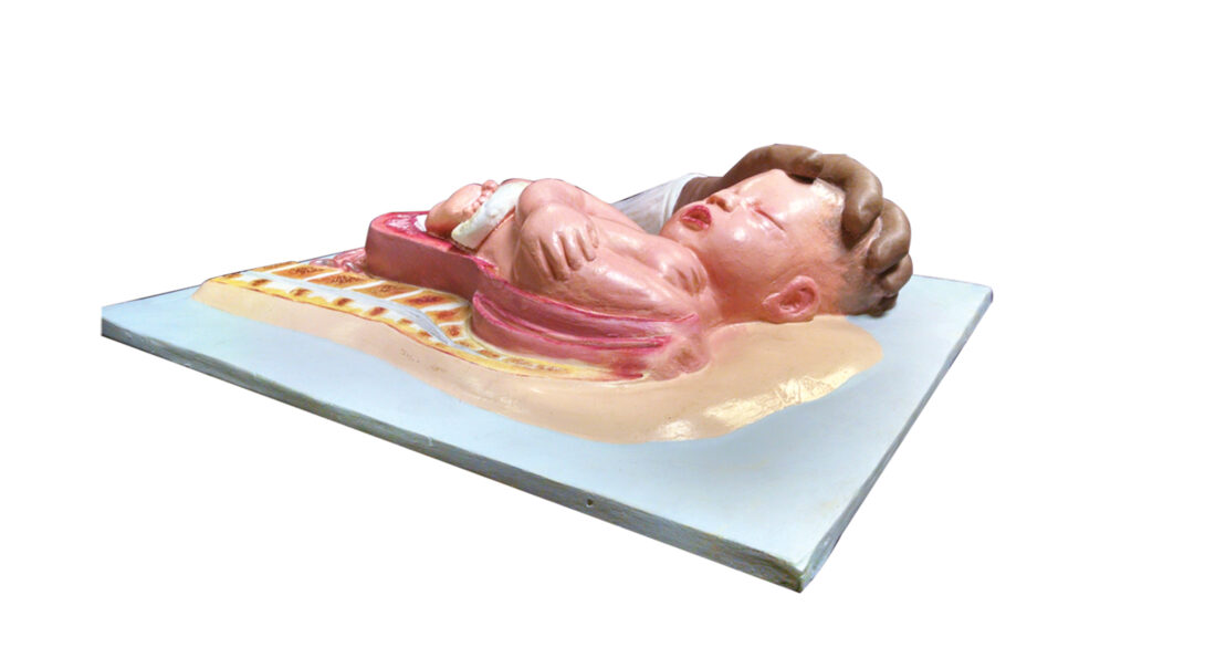 A plastic carving portrays a baby in utero, created by Holt.